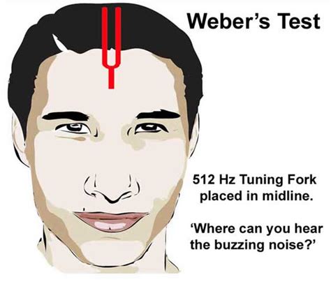 scratch test hearing|The use of the weber tuning fork test and ‘scratch test’ in .